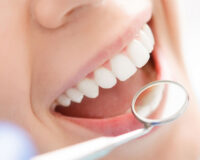 5 Ways You Can Take Care Of Your Teeth Better