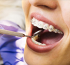 Orthodontic