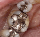 Biomimetic Dentistry